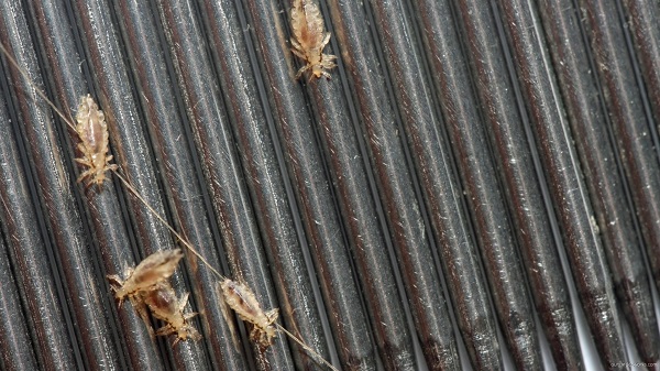 Head lice
